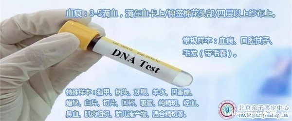 血痕亲子鉴定样本-100.jpg