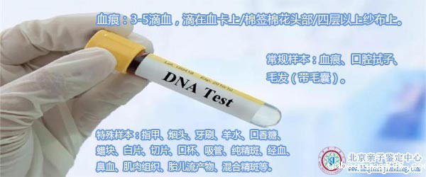 血痕亲子鉴定样本-50.jpg