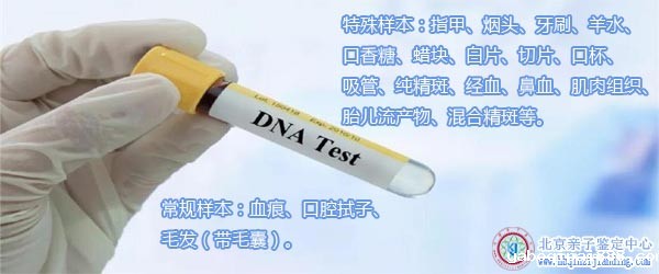 亲子鉴定样本.jpg